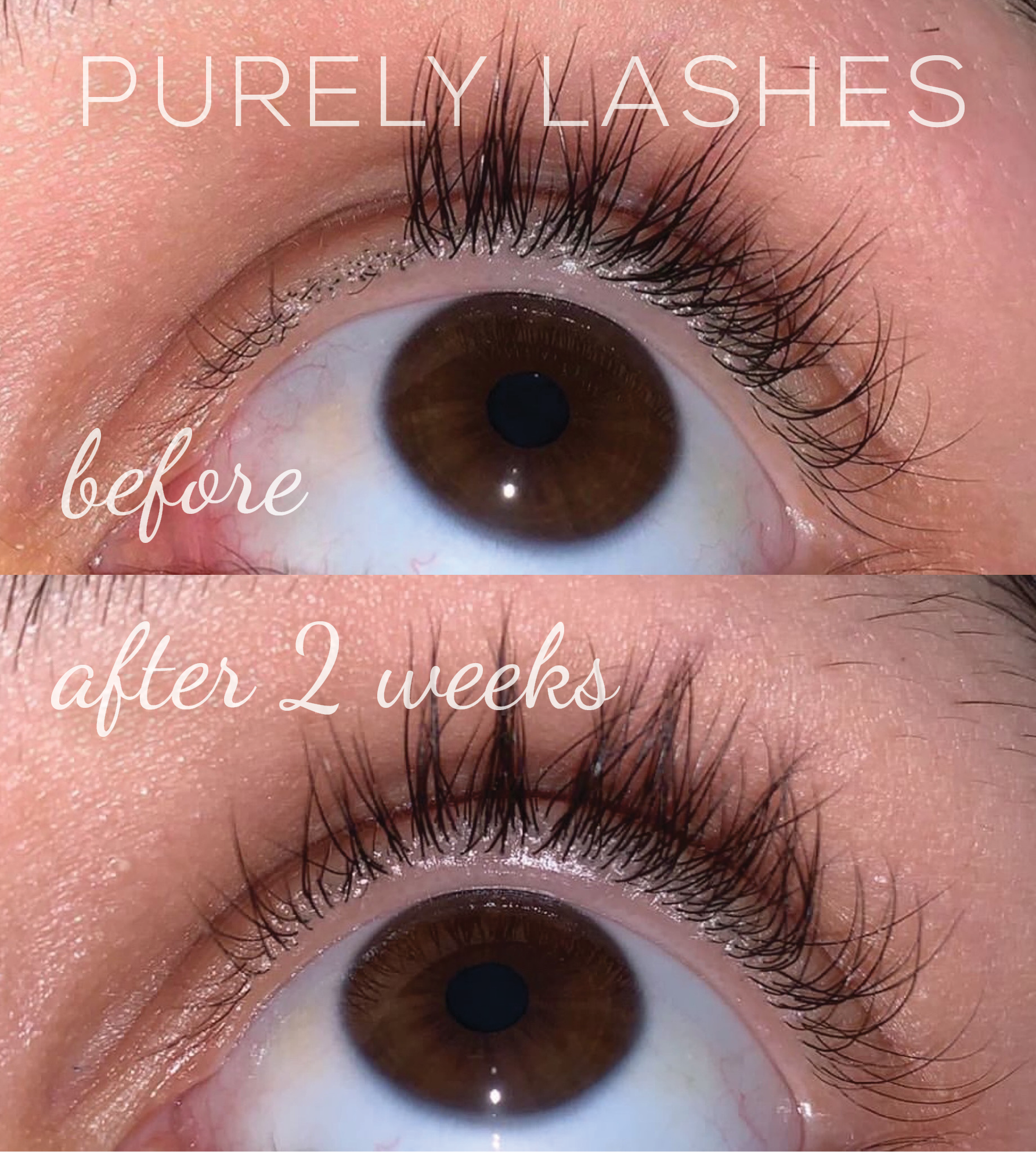 Before and after results photo of purely lashes growth serum on customer
